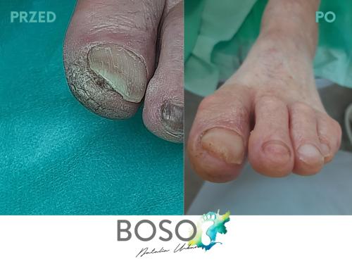 galeria-3-natalia-urban-podolog-swidnica-boso