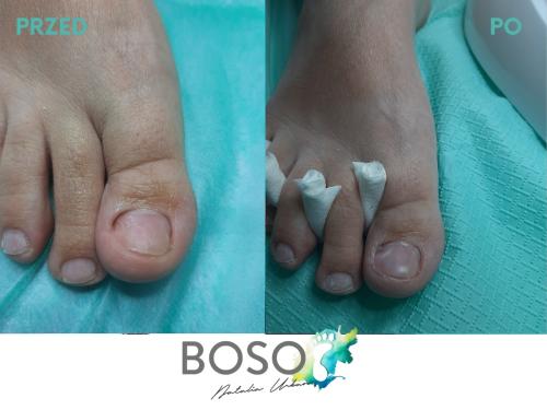 galeria-7-natalia-urban-podolog-swidnica-boso