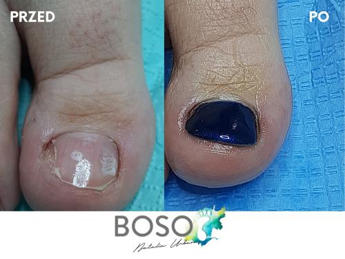 galeria-8-natalia-urban-podolog-swidnica-boso